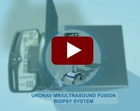 Ultrasound Fusion Biopsy System Video Still