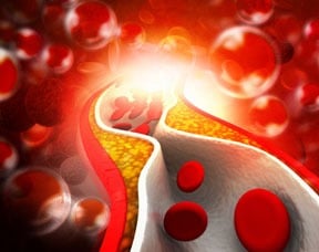 Can Cholesterol Drugs Kill Prostate Cancer Cells