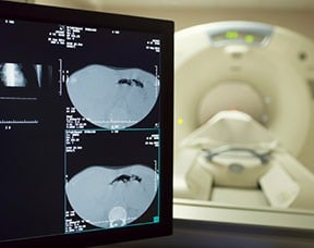 Using Ultrasound and MRI Together Increases Prostate Cancer Detection Thumbnail
