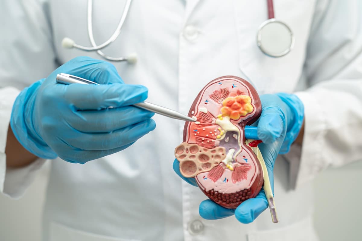 Essential-Insights-into-Kidney-Infections.jpg