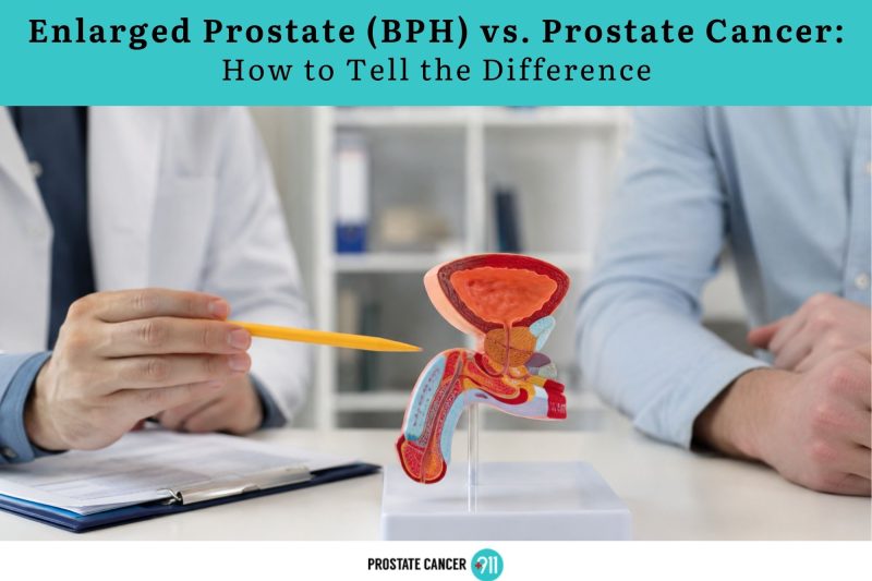 Enlarged Prostate (BPH) vs. Prostate Cancer How to Tell the Difference